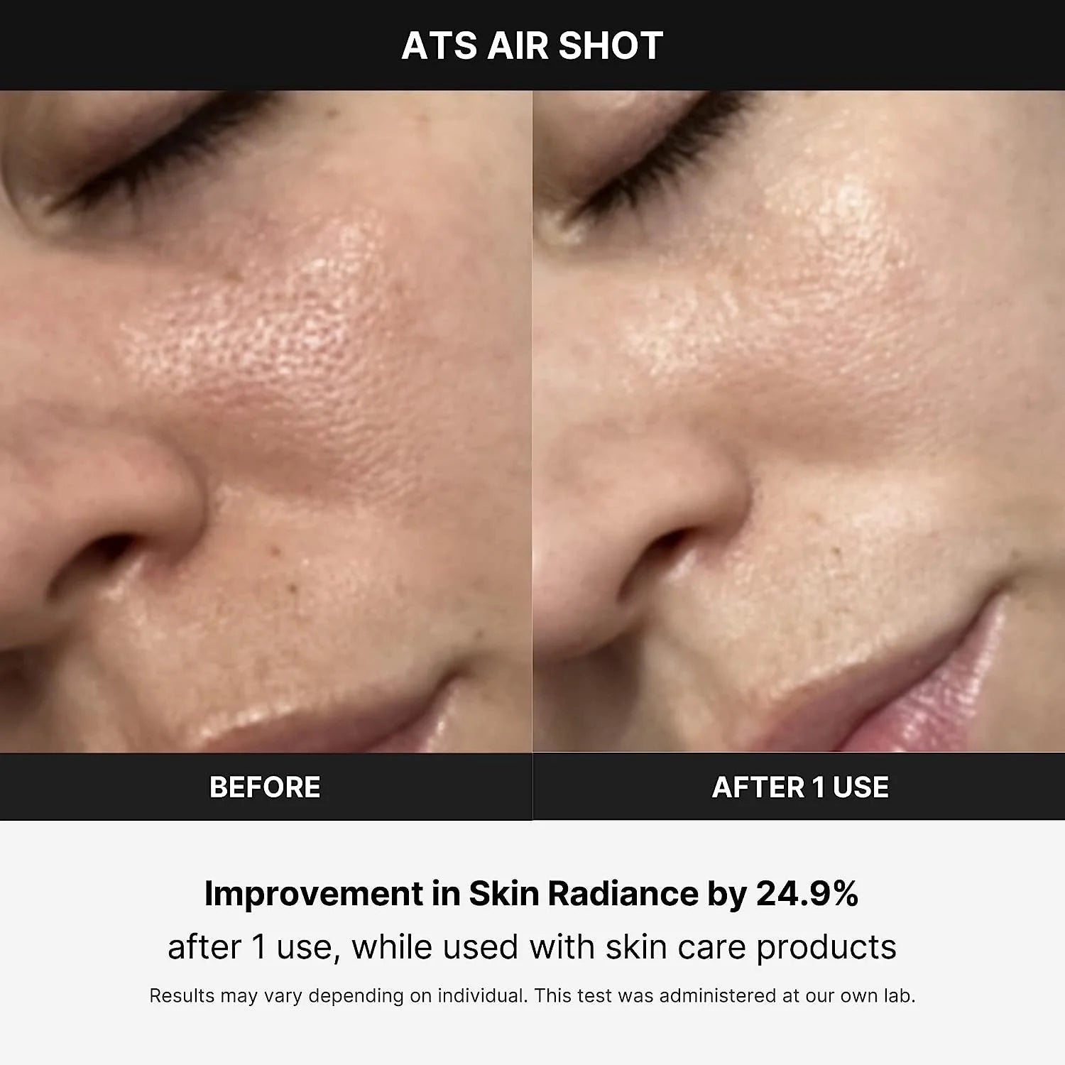 Age-R ATS Air Shot - Microneedling Pore Tightening Skin Care Device for Enhanced Absorption, Pore Refinement, and Smoother Skin Texture