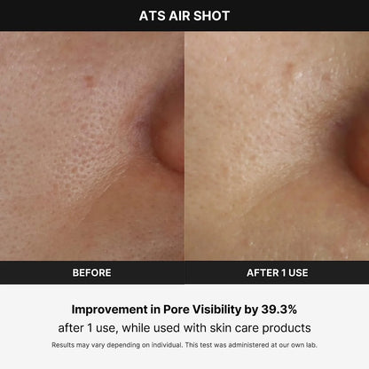 Age-R ATS Air Shot - Microneedling Pore Tightening Skin Care Device for Enhanced Absorption, Pore Refinement, and Smoother Skin Texture